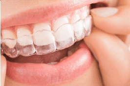 Read more about the article Mouth Guard at E Dental