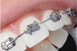 Orthodontics at E Dental